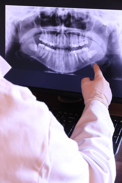 Best Dental Abscess Treatment in St Croix Falls, WI